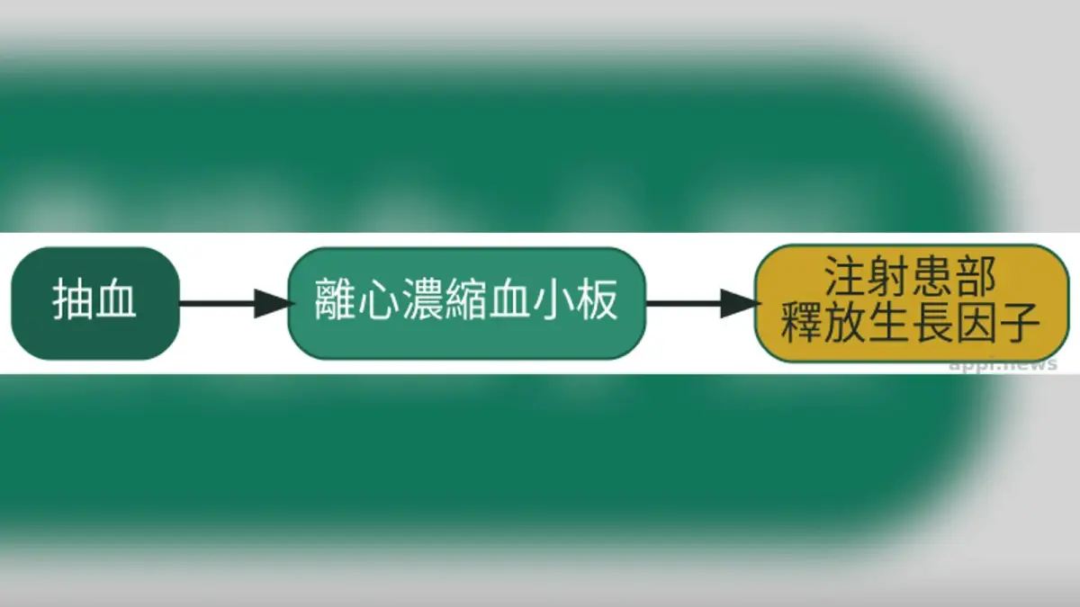 PLT凍晶治療流程示意圖，抽血、離心濃縮血小板、注射患部釋放生長因子三步驟以箭頭依序連接