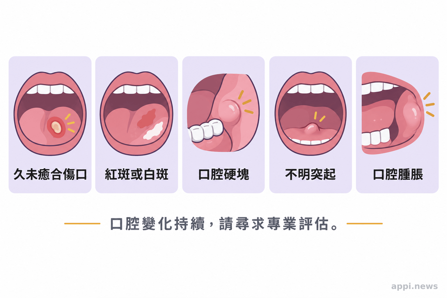 口腔自我觀察五項提示:傷口、紅白斑、硬塊、突起與腫脹