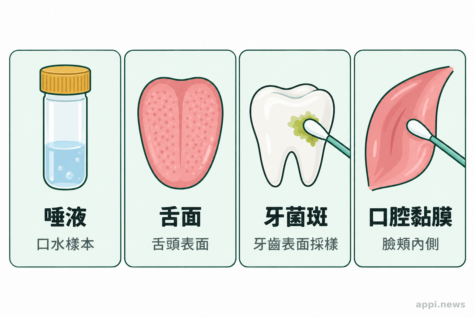 唾液、舌面、牙菌斑與口腔黏膜的四種採樣位置示意