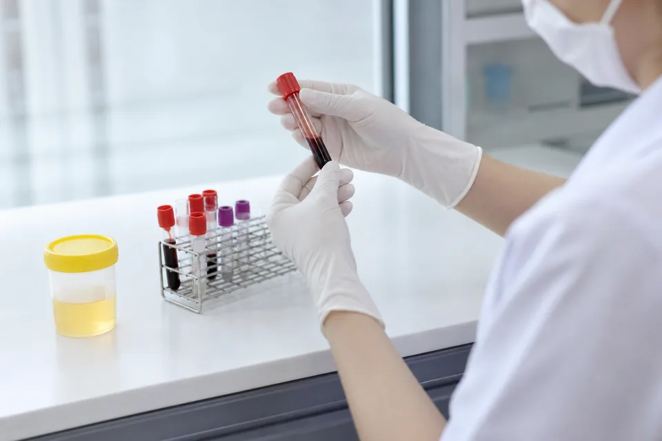 尿液檢查與腎功能抽血示意