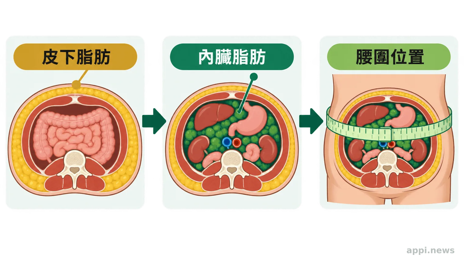 皮下脂肪、內臟脂肪與腰圍測量位置比較示意圖